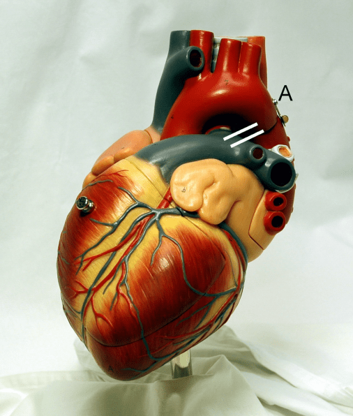 Model of a human heart